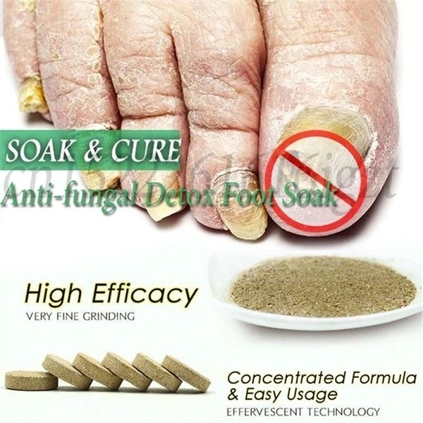 Fungal Nail Treatment Detox Foot Soak Long-Term Relief Athlete's Foot,Foot Skin Cracking