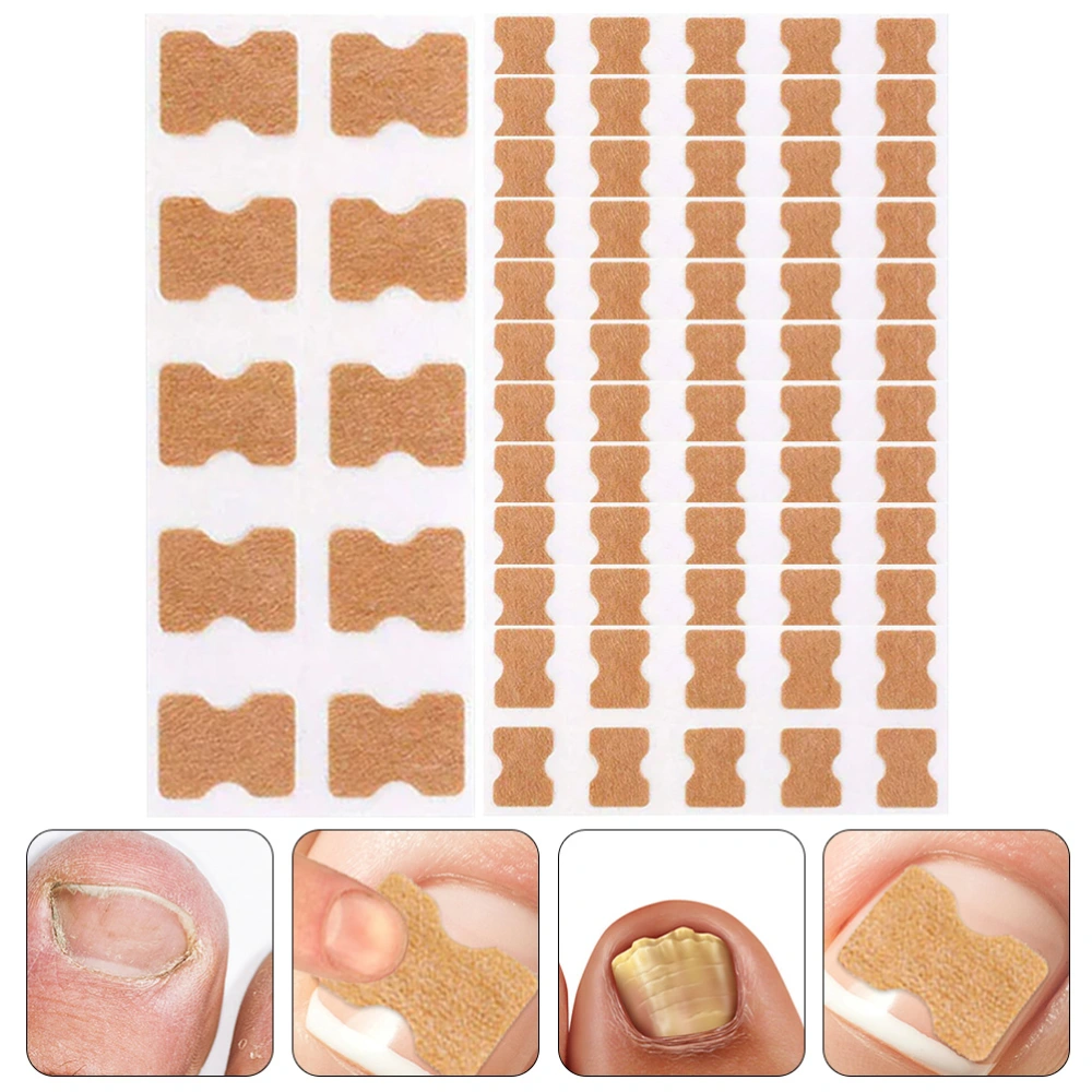 40 pcs Toenail Correction Patch Nail Corrector Patch Ingrown Nail Correction Strips