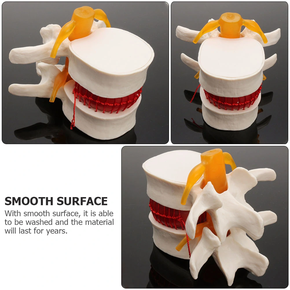 1pc Human Spine Model Lumbar Disc Herniation Presentation Model for School