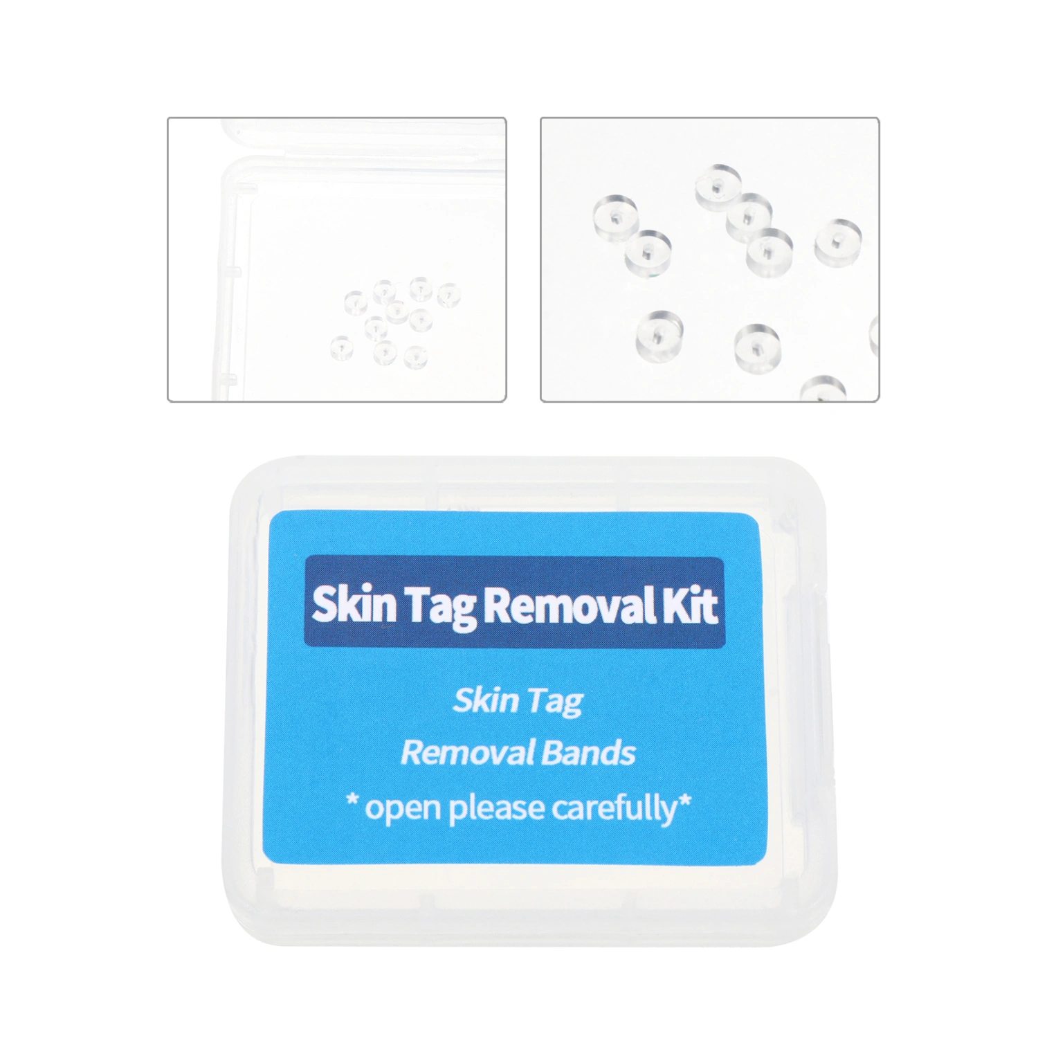 1 Set/30pcs Wart Tag Removal Equipment Skin Tag Removal Band Skin Tag Remover