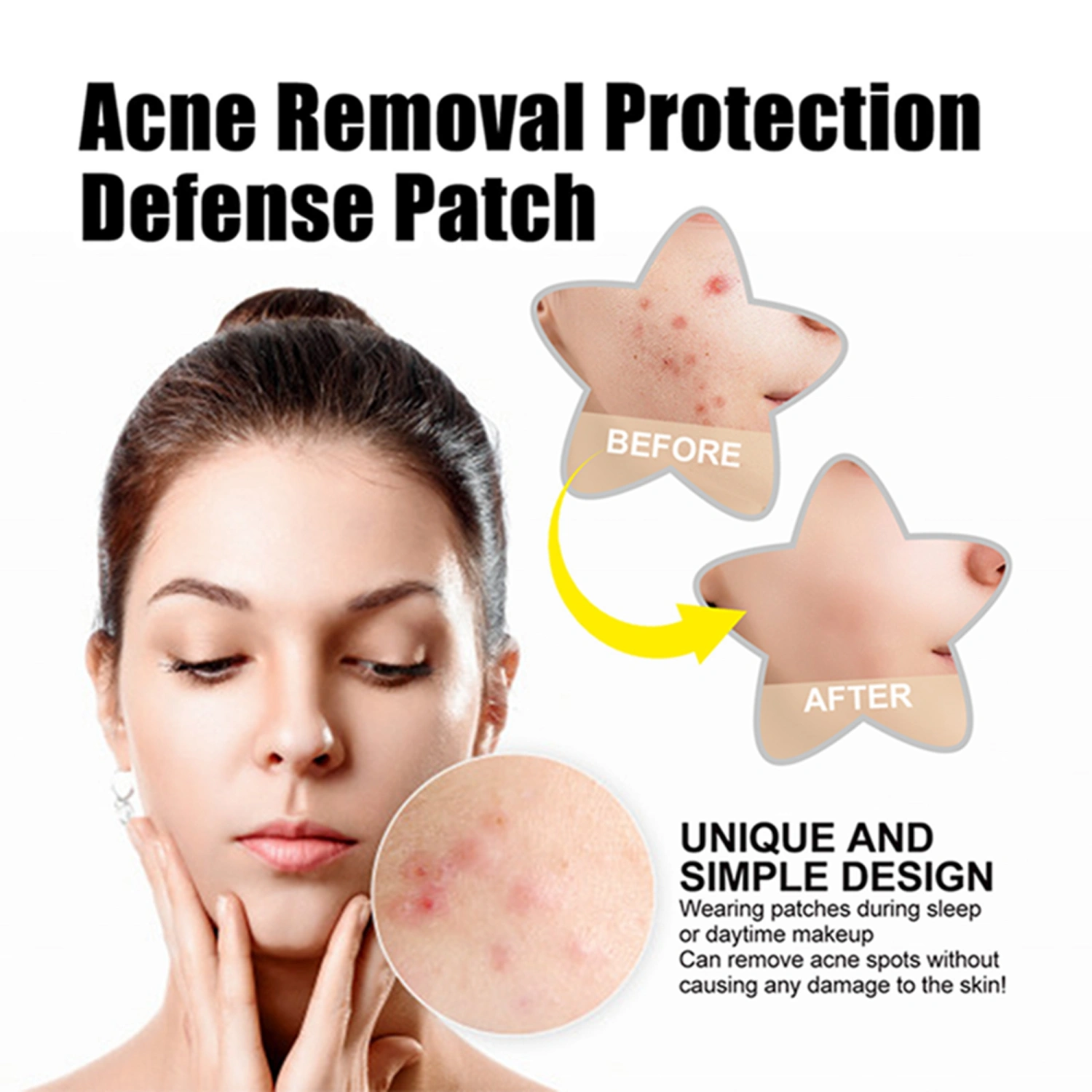 60pcs Acne Patches, Colorful Pimple Patches Skin Care Acne Sticker