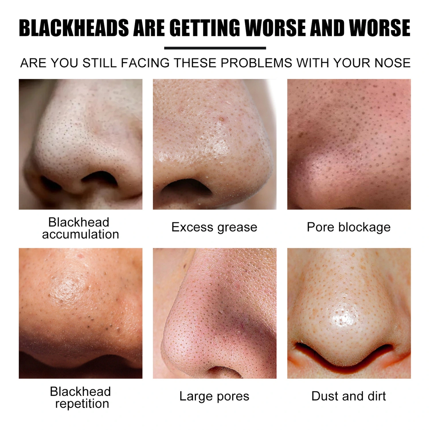 Blackhead Pore Strips, Blackhead Remover Deep Cleansing Charcoal Strip