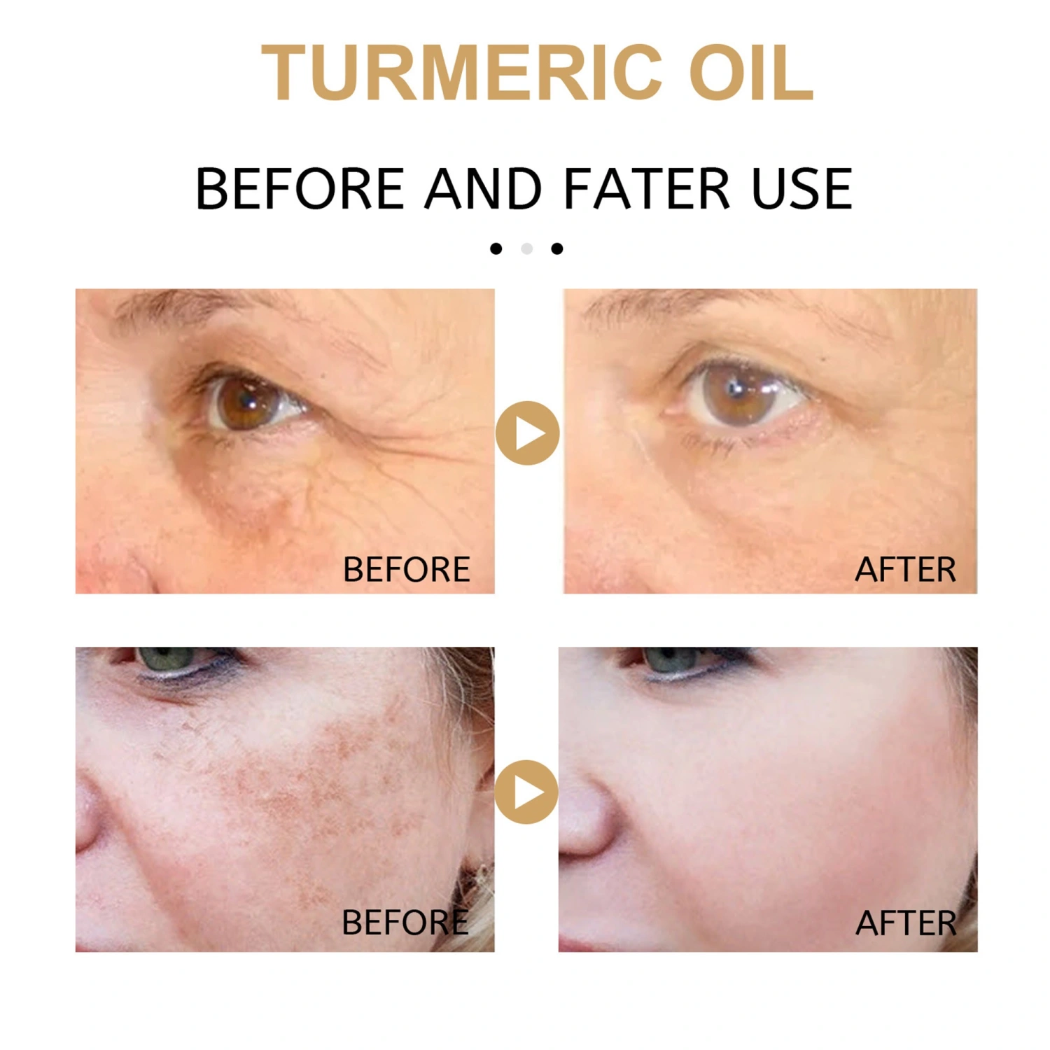 Turmeric Oil, Natural Essential Oil Anti-Aging Dark Spots Corrector