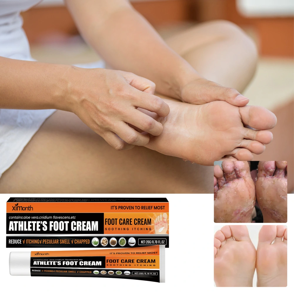 Foot Neck Cream Anti-chapping Peeling Chapped Foot Qi Relieve Itching