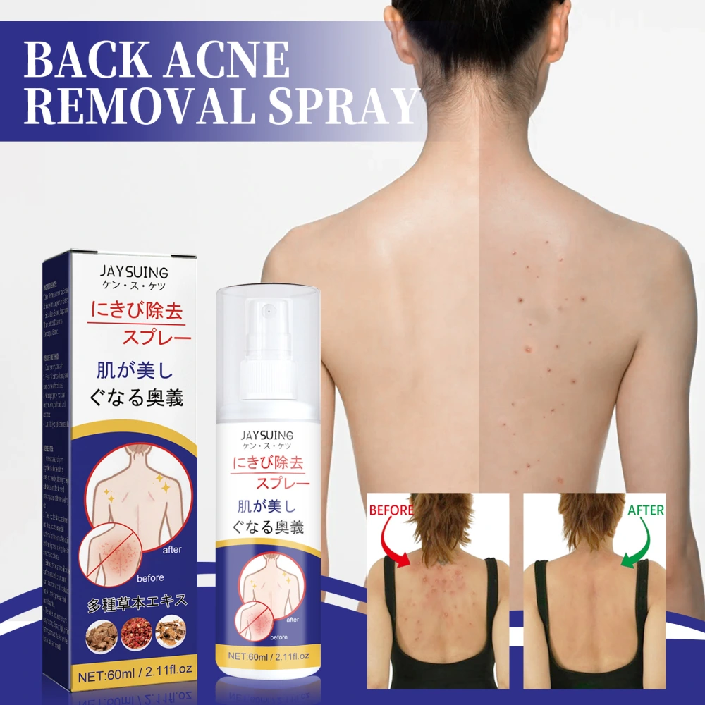 Back Care Spray Smallpox Diluting Back Acne Cleaning Repair