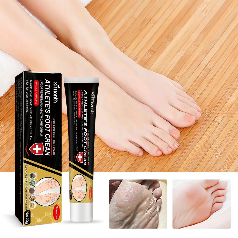 Foot Deodorant Cream Anti-itching Deodorant Anti-rot Feet Dry Peeling Care