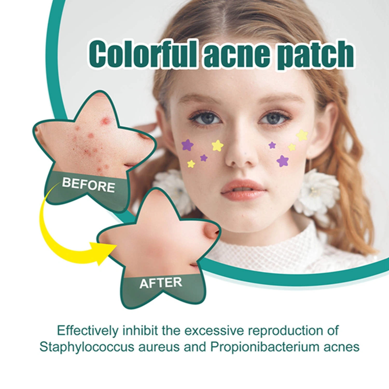 112 PCS Acne Patch for Face Tea Tree Oil Invisible Acne Pimple Patches
