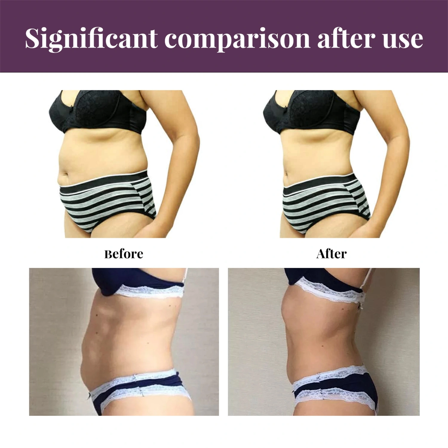 Belly Patch, Sweatproof Patches, Toning Contouring Firming Patches