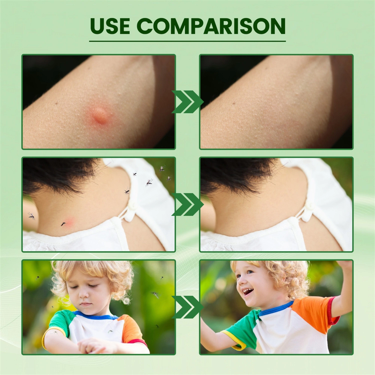 Natural Bug Repellent & Insect Repellent, Anti Itch Ointment