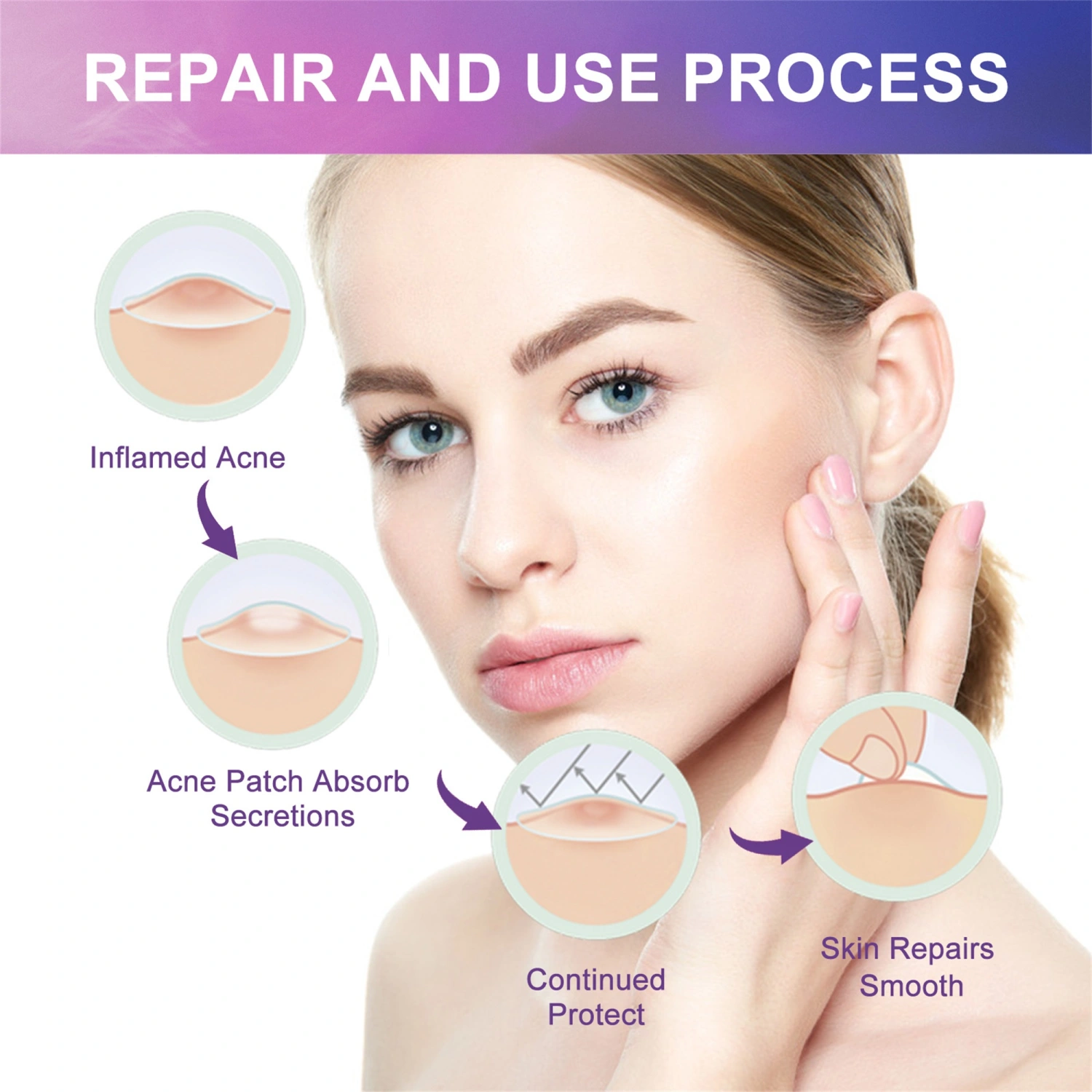 Hydrocolloid Acne Patch Acne Pimple Patch for Covering Large Breakouts