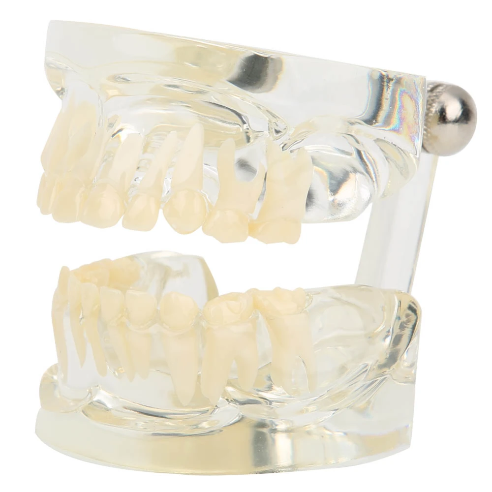 Clear Primary Model Deciduous Teeth Model for Kindergarten Hospital Laboratory Use