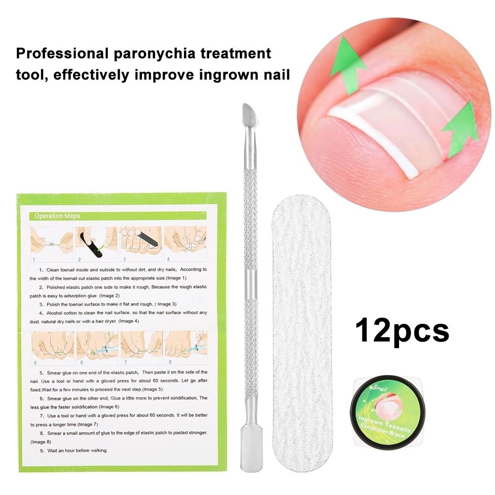 12Pcs Professional Nail Correction Sticker Pedicure Paronychia Recover Foot Care Tool