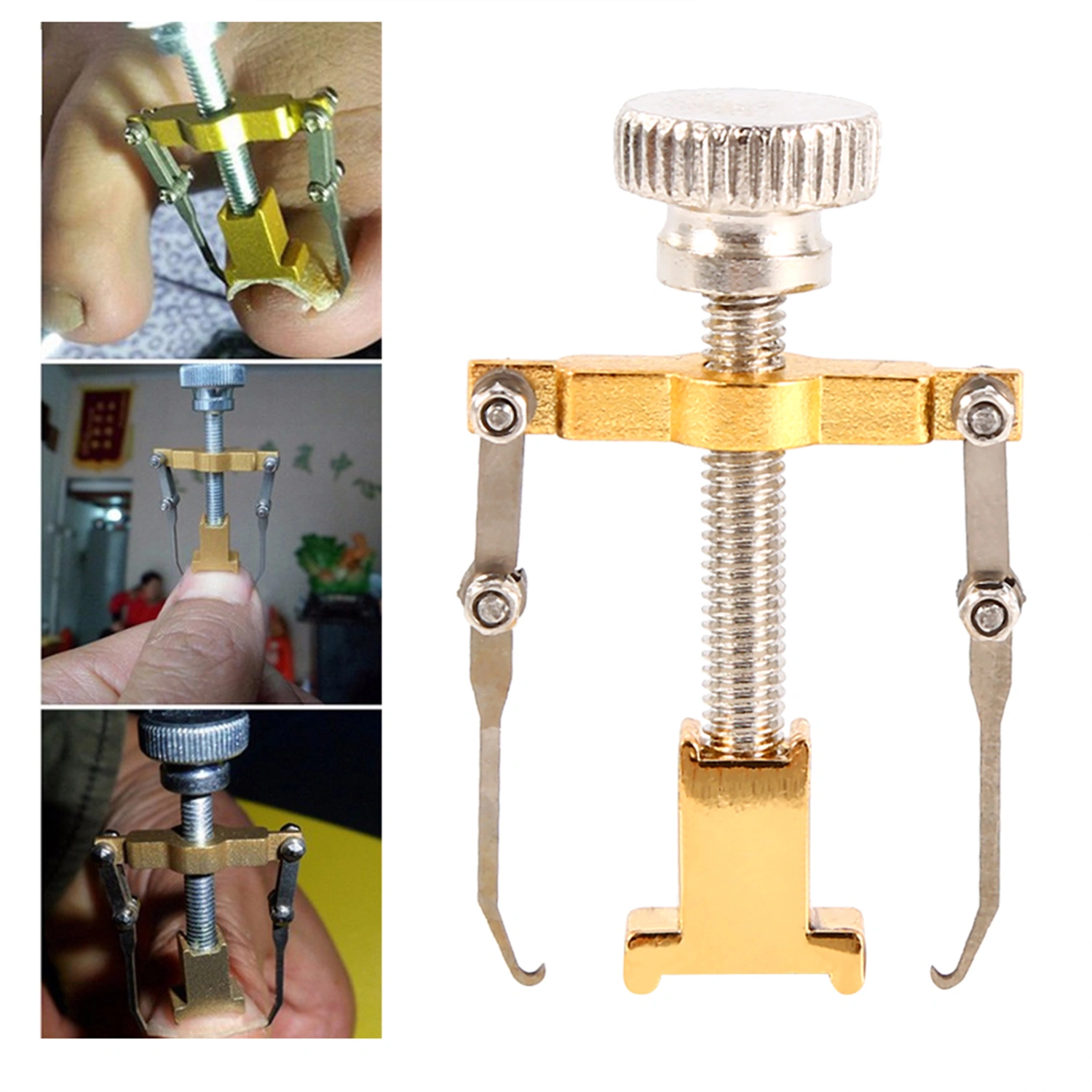 Professional Ingrown Toe Nail Recover Correction Fixer Manicure Pedicure Nails Care Tool