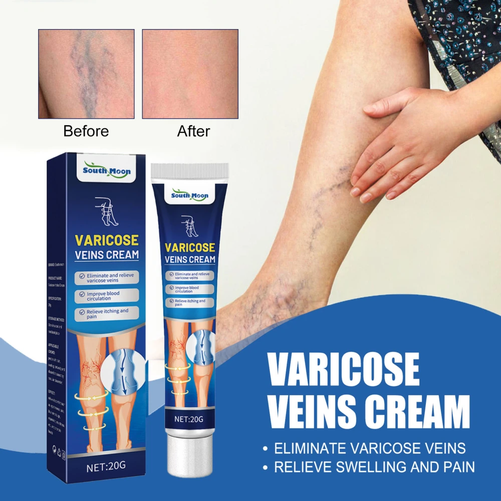 20g Varicose Vein Cream Non-irritating Natural Extract Varicose Vein Relief Vasculitis Phlebitis Spider Web Pain Treatment for Unisex