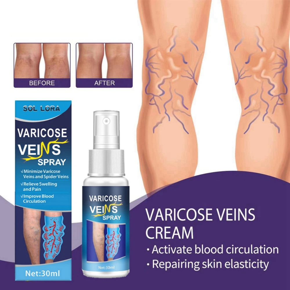 30ML Varicose Vein Massage Spray Relieve Leg Discomfort Improve Circulation Gentle Effective Varicose Spray