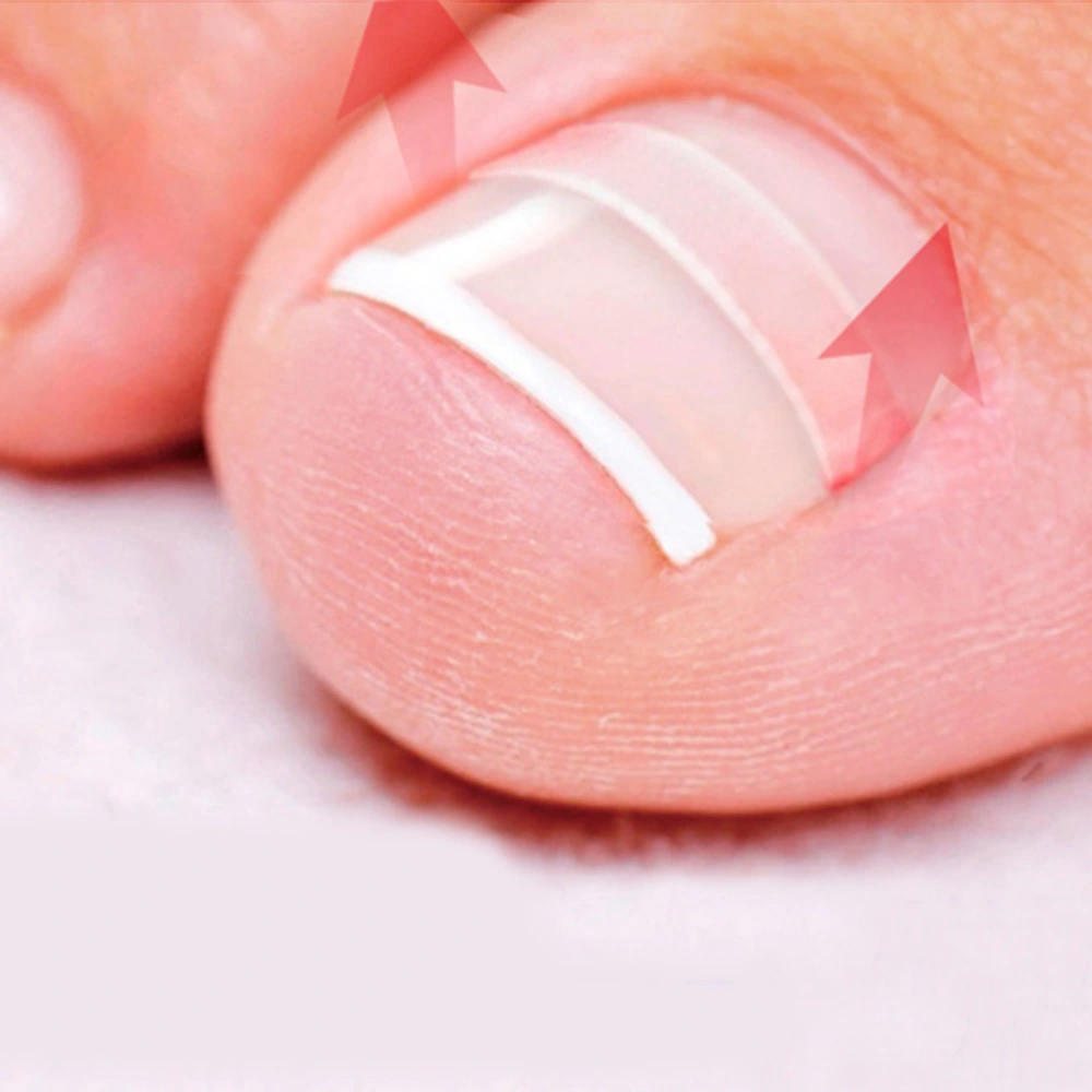 120pcs Toe Nail Correction Sticker Patch Paronychia Corrector File Elastic Patch Corrector