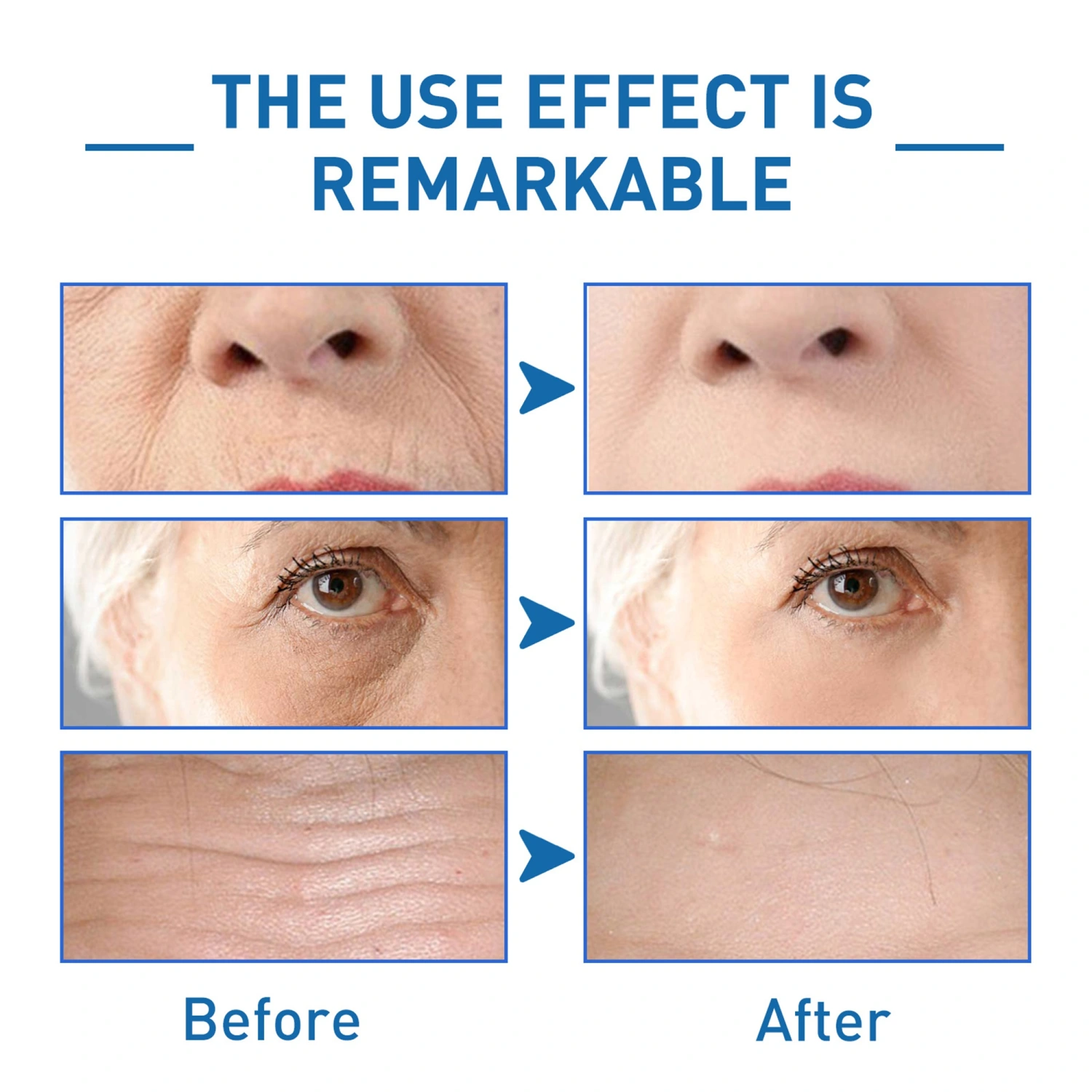 B5 Essential Oil Anti-wrinkle Moisturizer Anti-Aging Skin Care Product