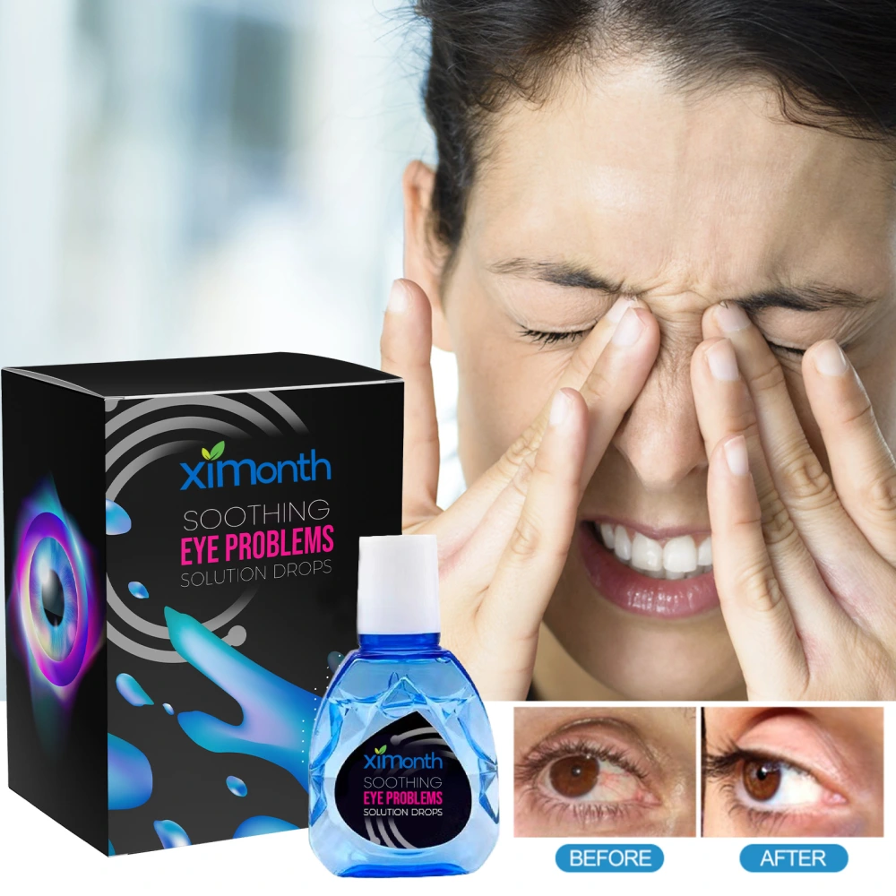 Nursing Dryness And Itching For Relieving Fatigue Eye Drops