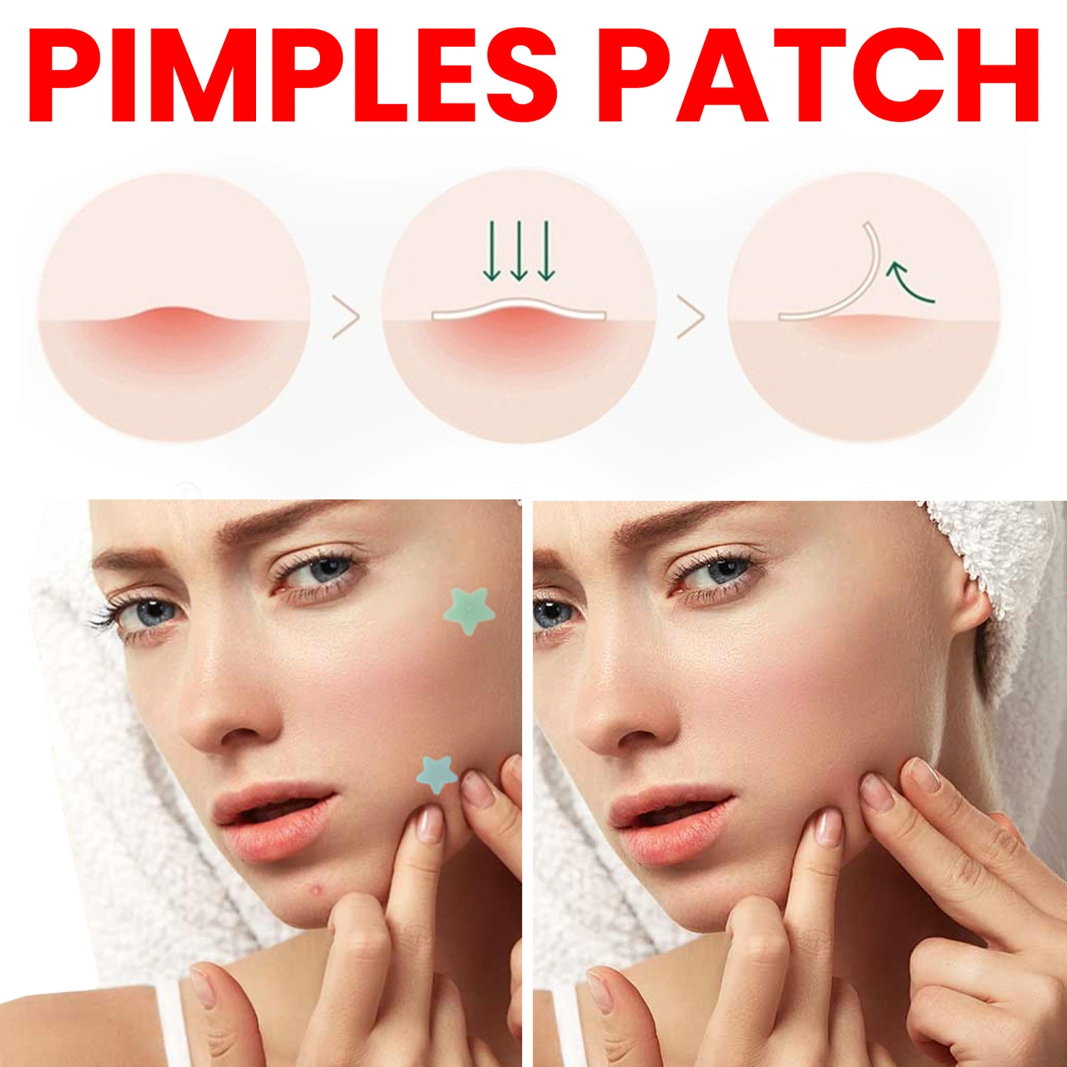 Pimple Patches Star Hydrocolloid Acne Patches Zit Absorbing Patch 