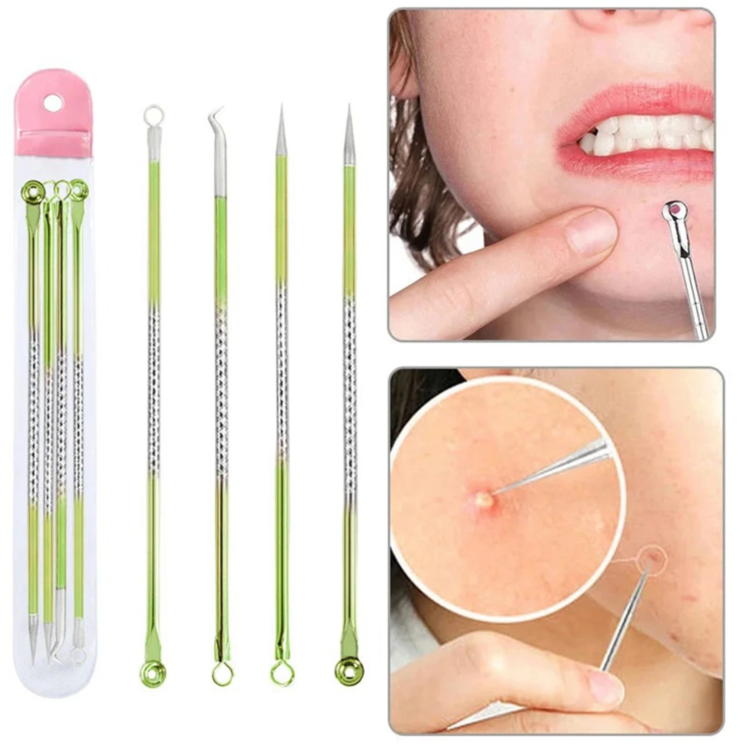 4pcs Acne Needles Stainless Steel Pimple Popper Blackhead Remover Tool