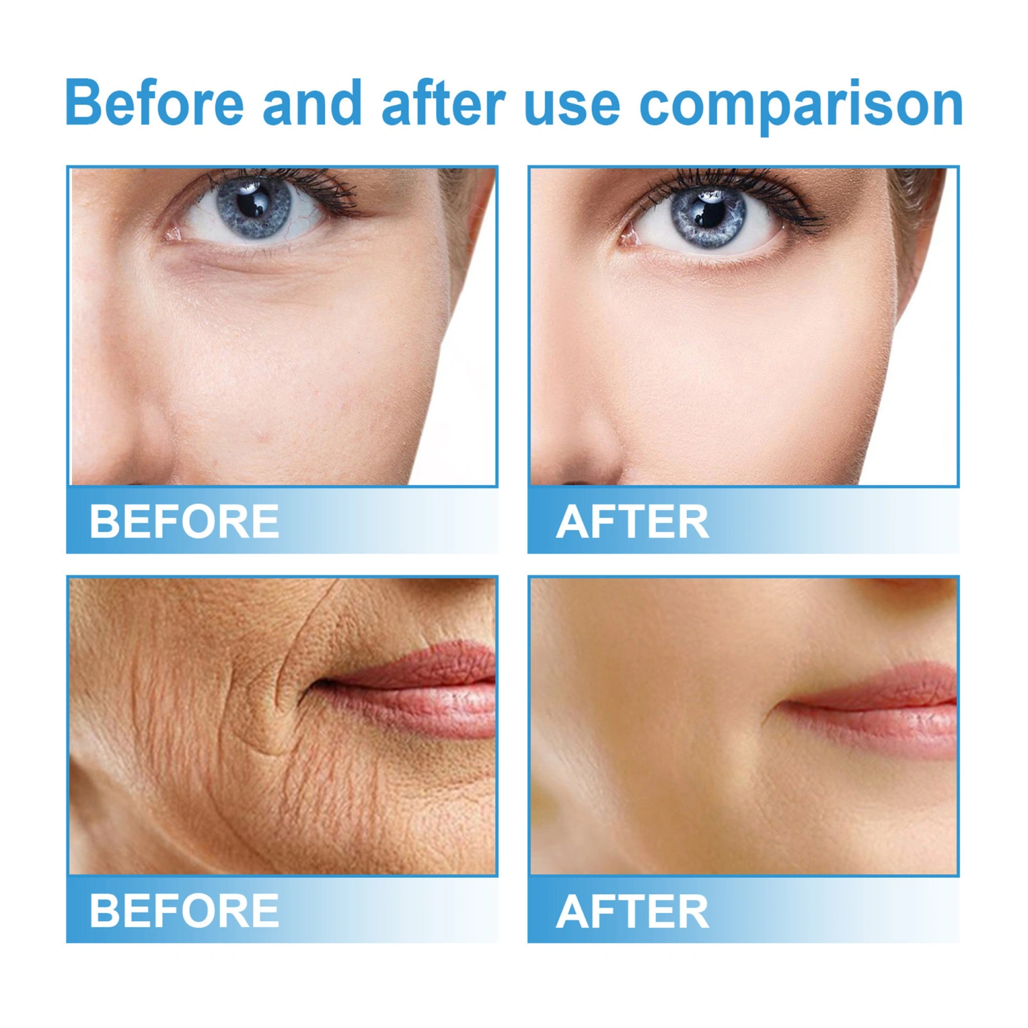 Facial Cream Anti-Freckle Cream Anti Wrinkle Face Cream for Skin