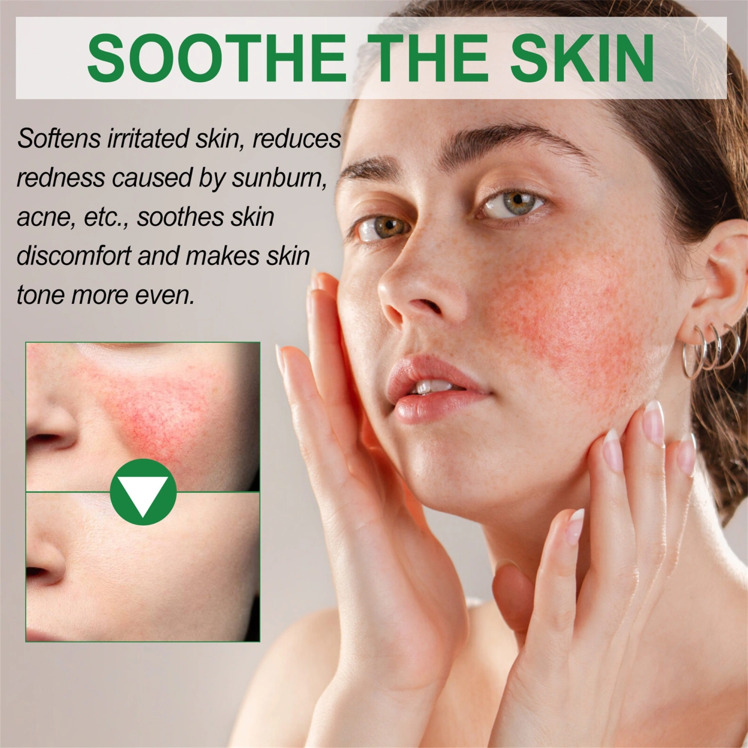 Color Correcting Cream Redness Corrector Blemish Treatment Moisturizer