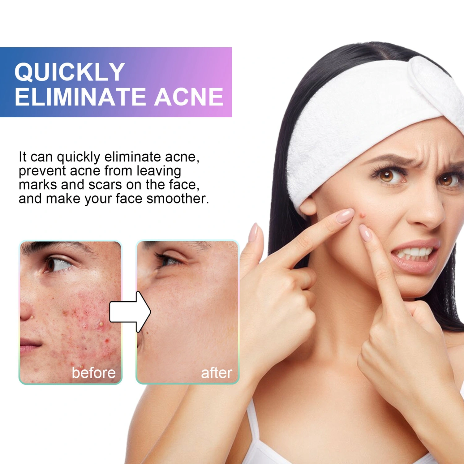 Colorful Pimple Patches Sea Life Shaped Acne Patches Zit Patch 