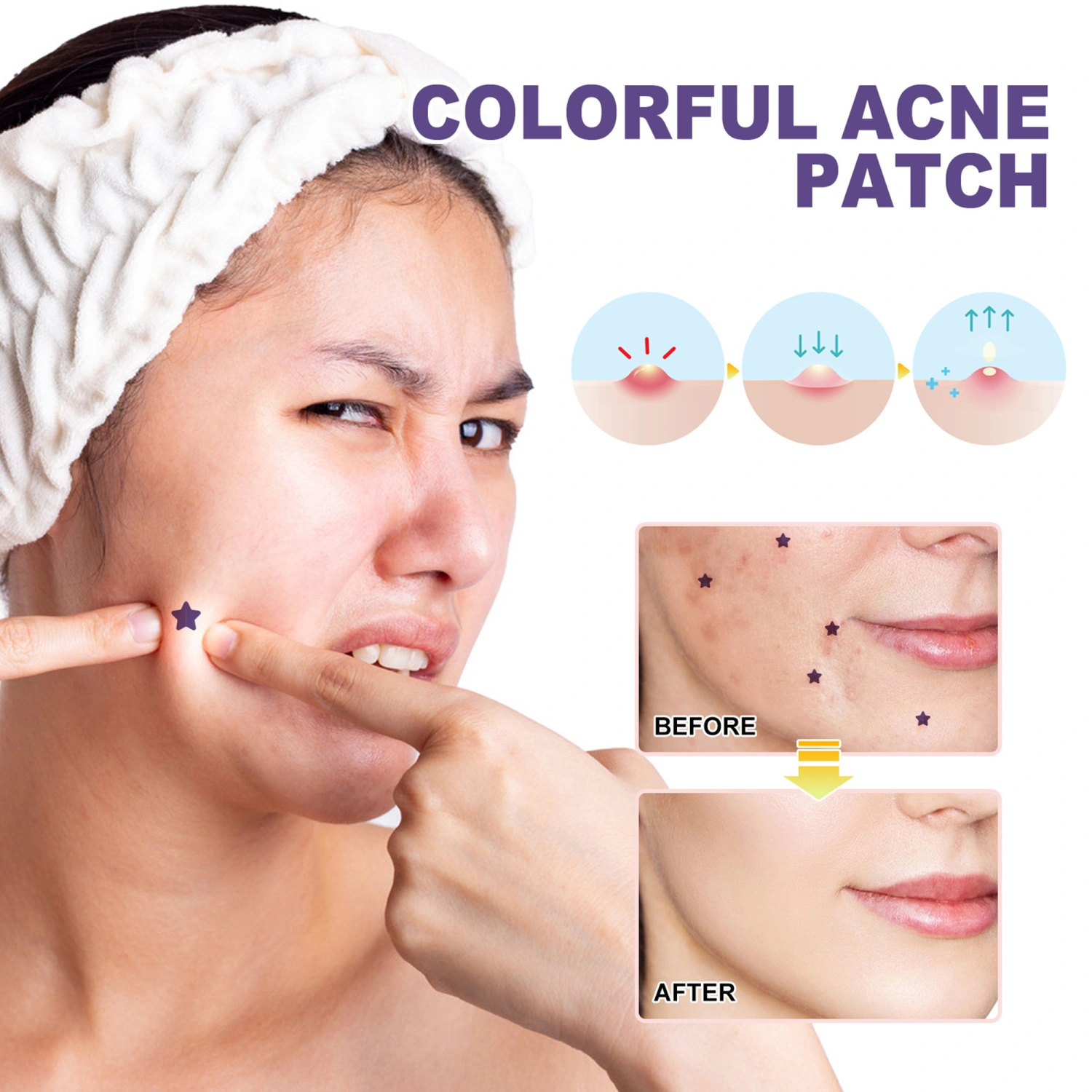 Acne Patch Pimple Patch, Purple Acne Absorbing Cover Patch Zit Patch