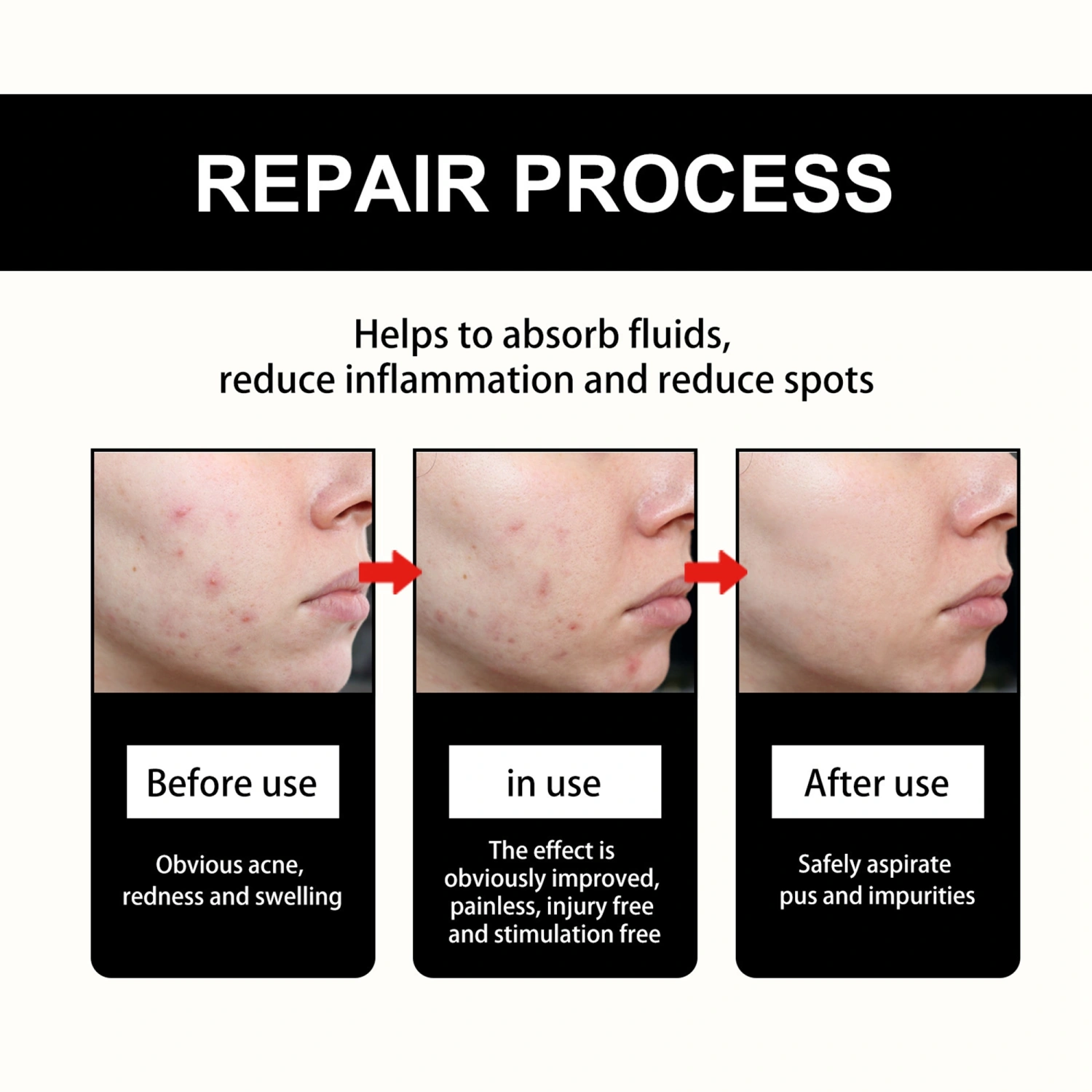 Cute Pimple Patches Heart/Star Shape Acne Patches Zit Absorbing Patch