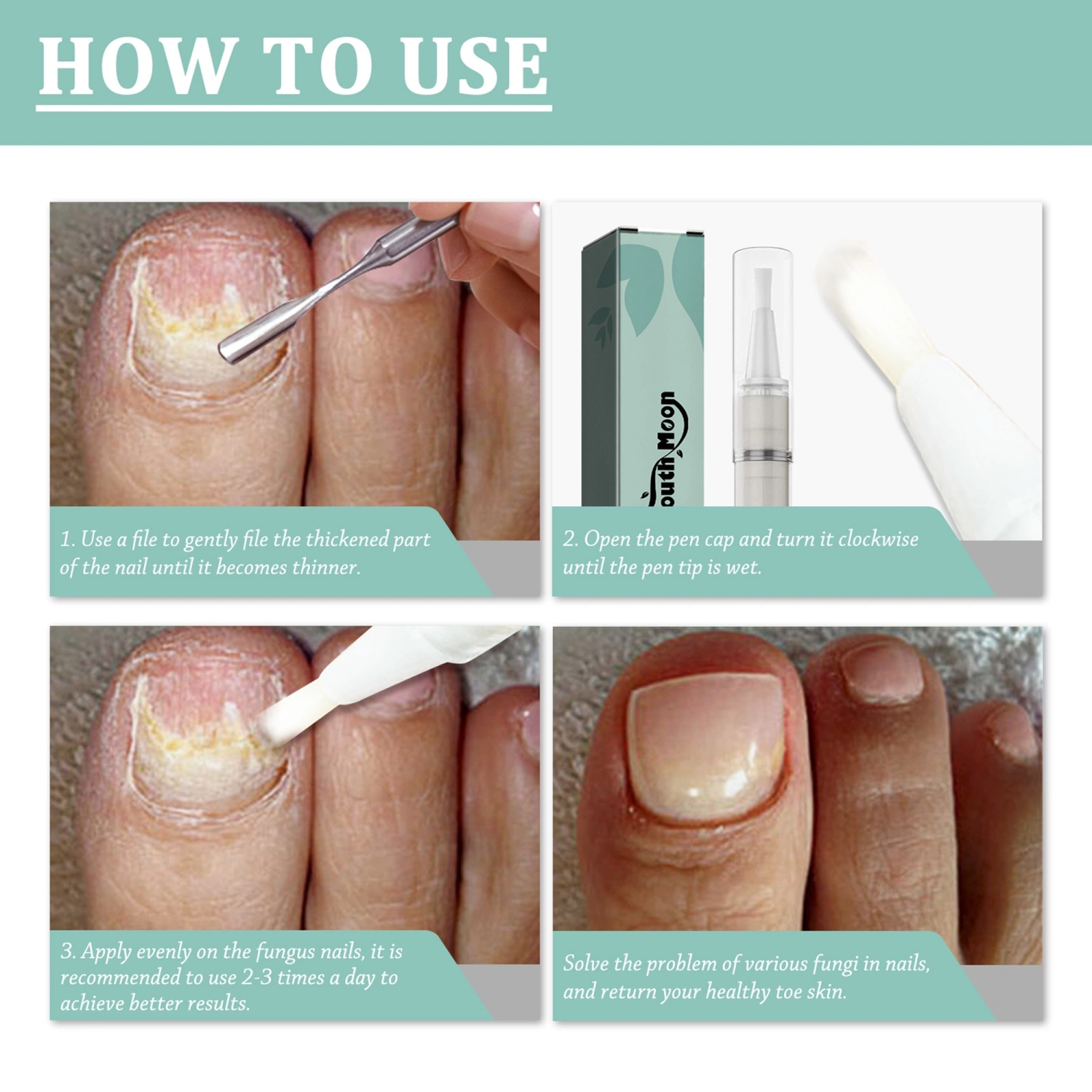 Fungus Nail Pen Nail Care Repair Solution Fungal Nail Treatment 