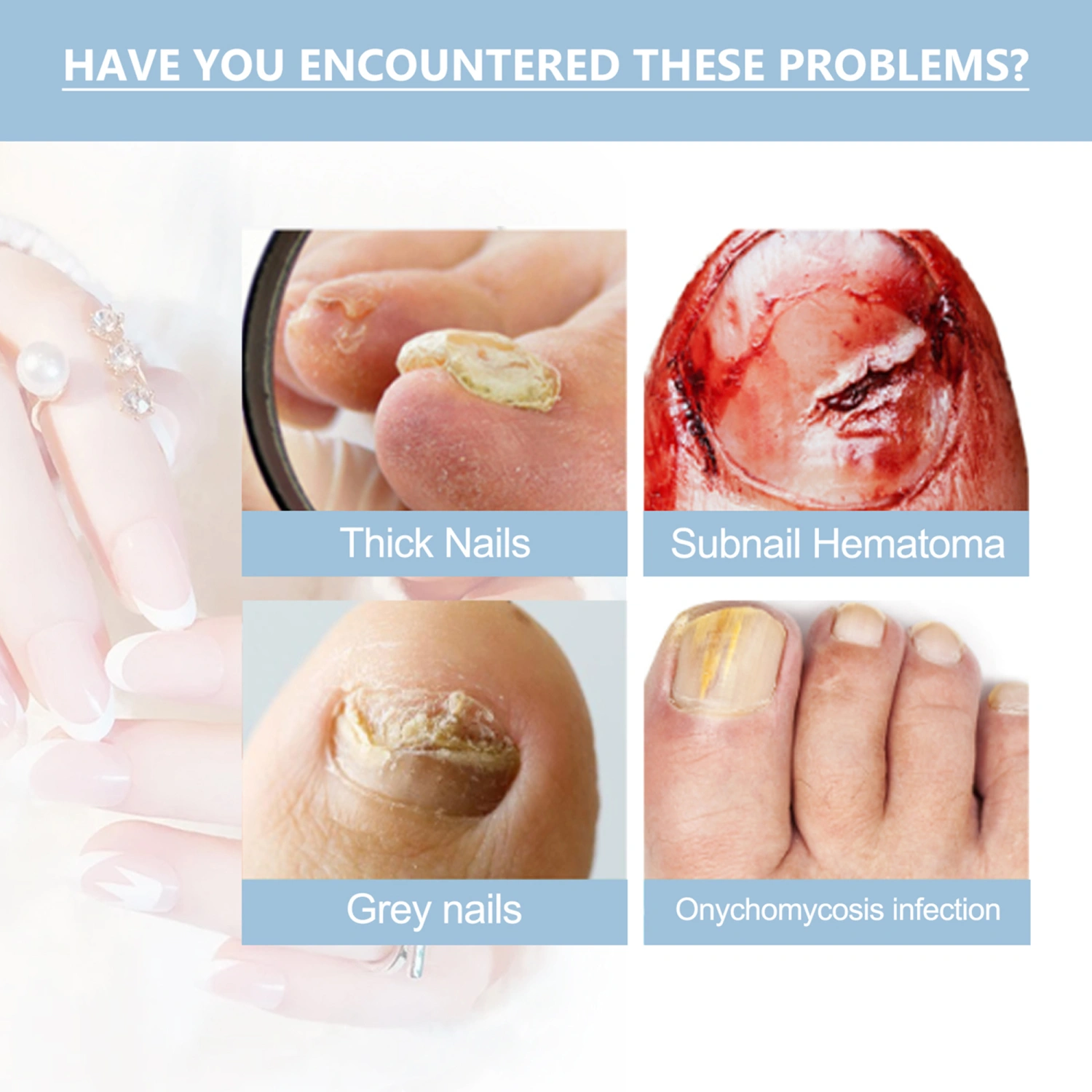 Nail Growth Oil, Nail Strengthener for Thin Nails and Growth