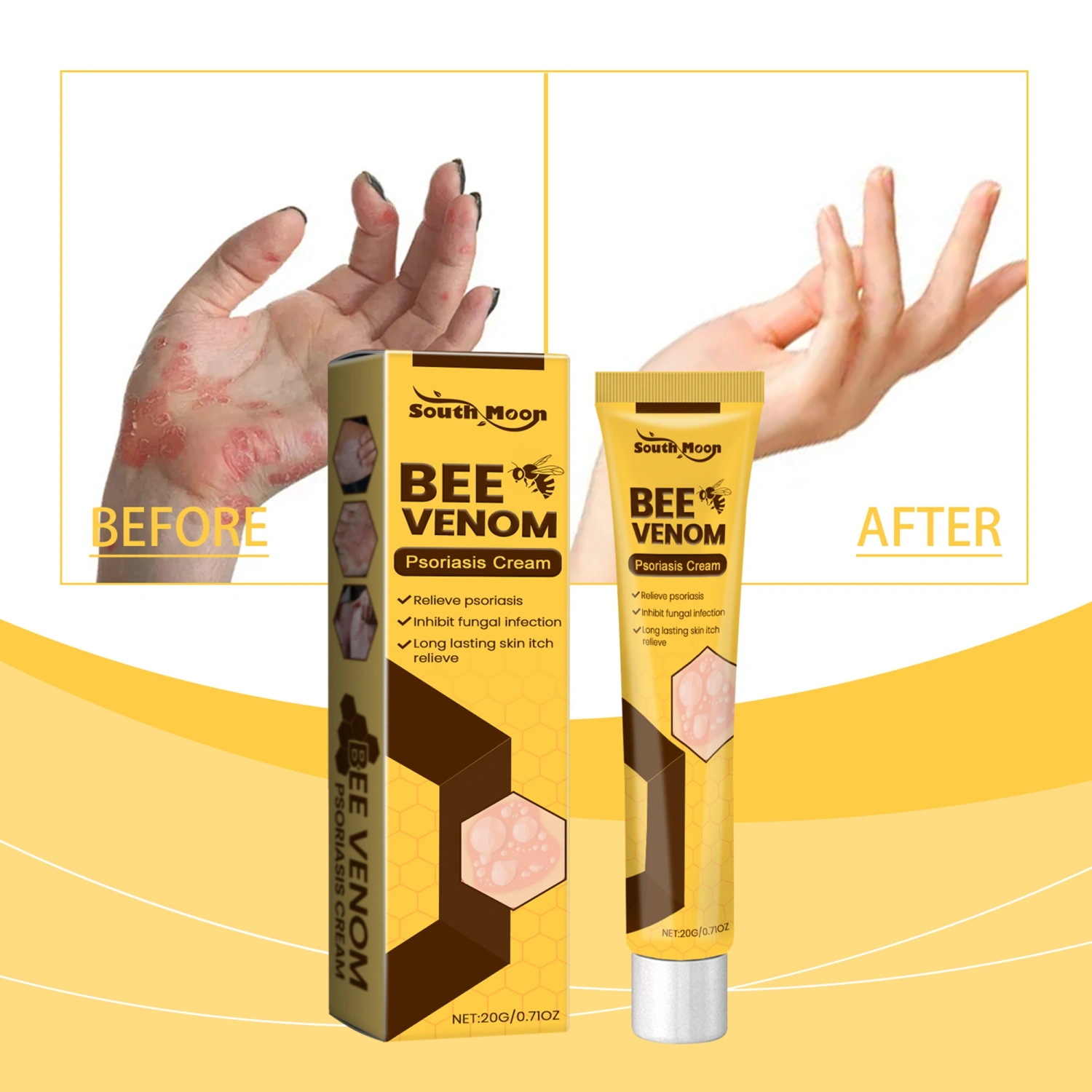 Bee Venom Psoriasis Cream Inhibit Fungal Itch Relieve Product