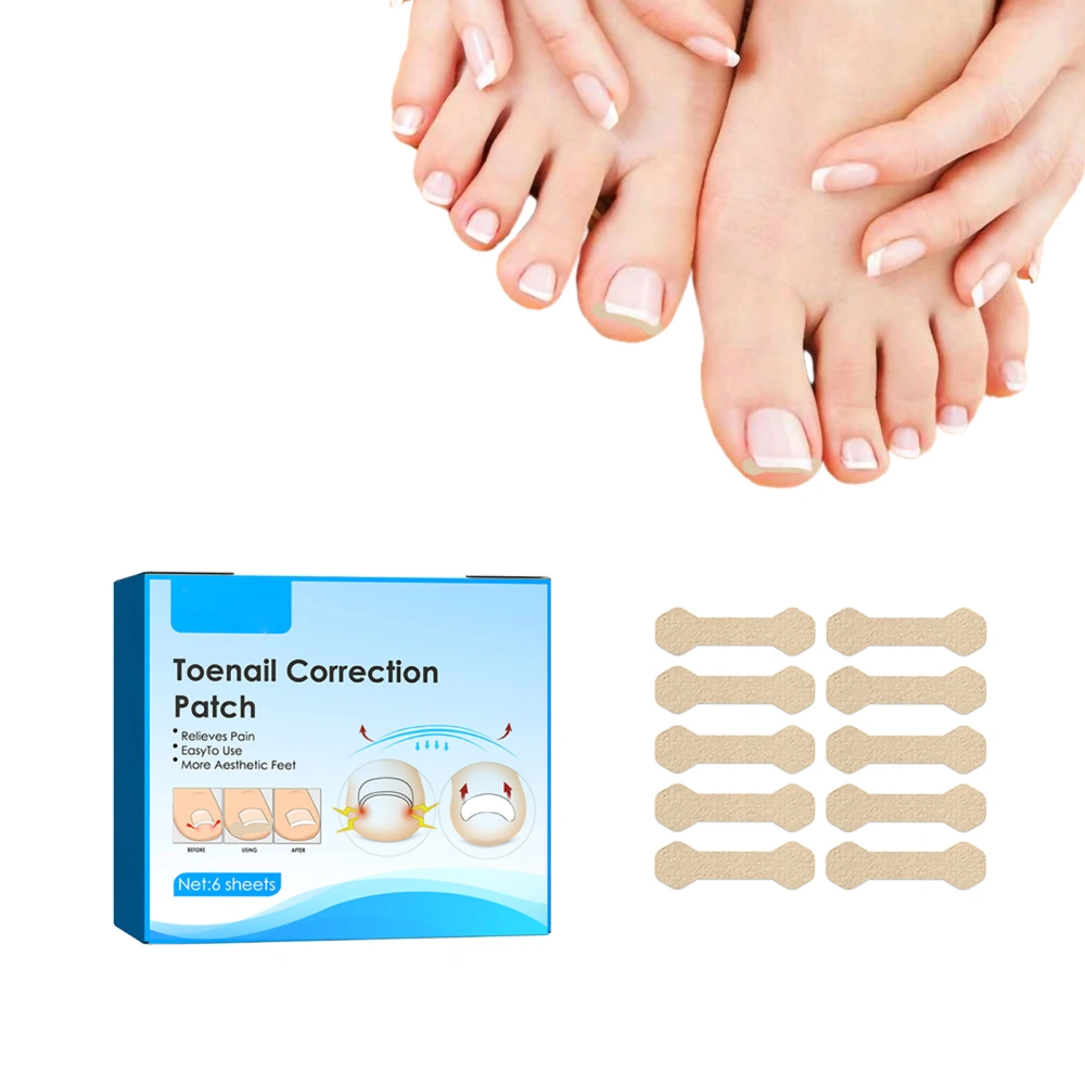 Ingrown Toenail Corrector Stickers Toenail Corrector Patch Nail Correction Tool Nail Corrector Patch Pedicure Tools