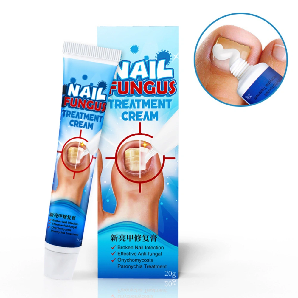 20g Nail Fungus Cream Toenail Fungus Remover Toenail Fingernail Fungus Remover Cream