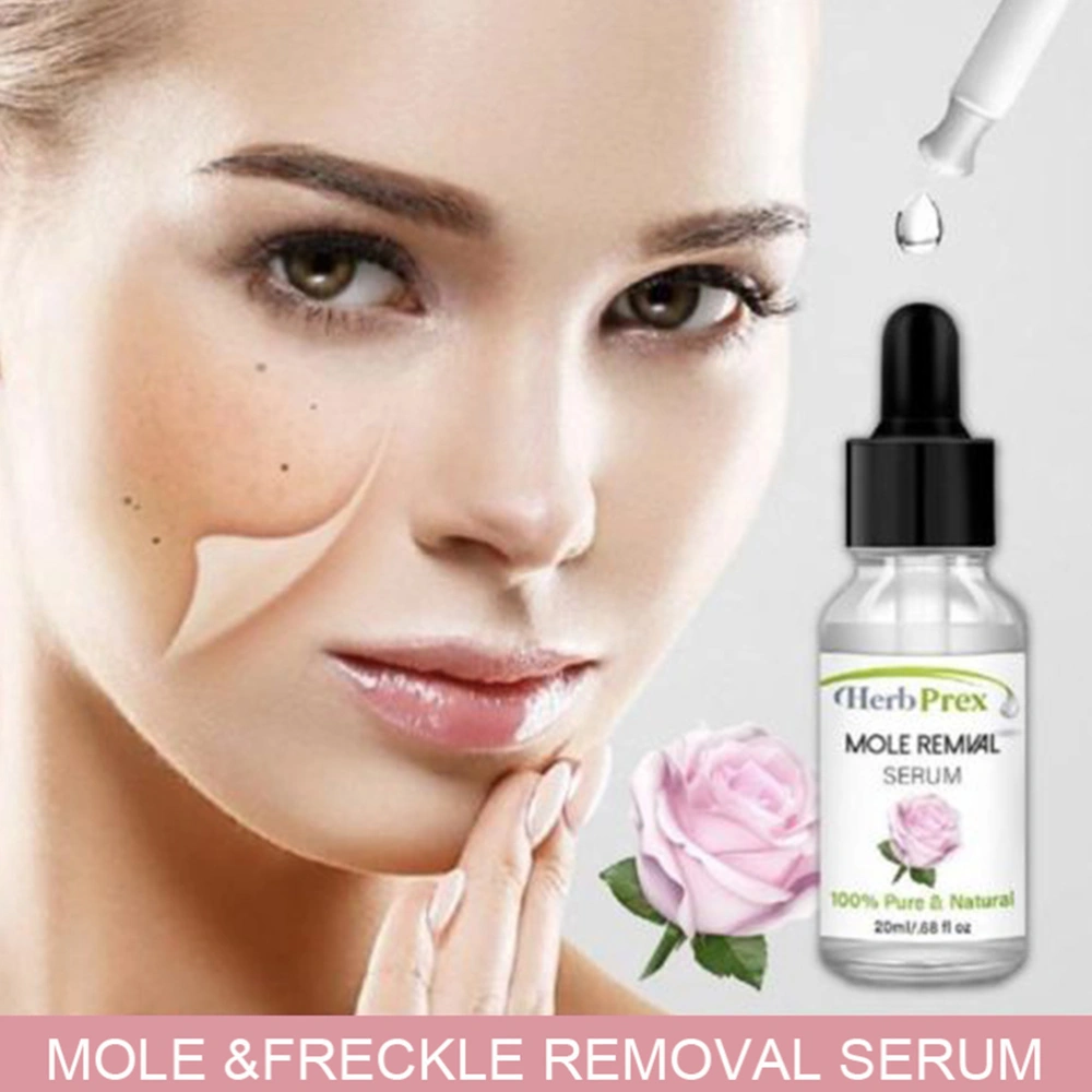 20ml Wart Mole Removal Serum Mole Freckle Spot Fast Remover Serum