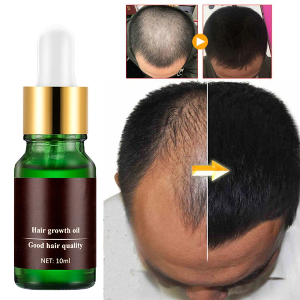 Natural Hair Loss Hair Growth Oil No Side Effects Grow Hair Faster Regrowth Hair Growth Products