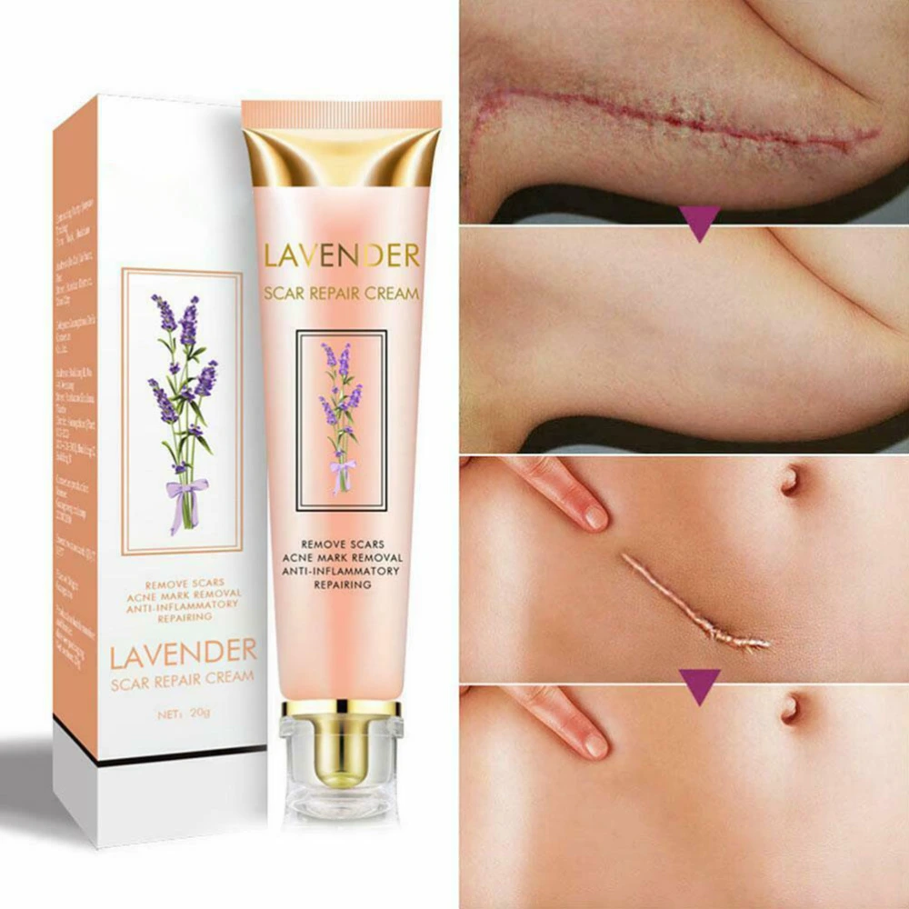 20g Acne Scar Stretch Mark Remover Cream Lavender Scar Removal Cream