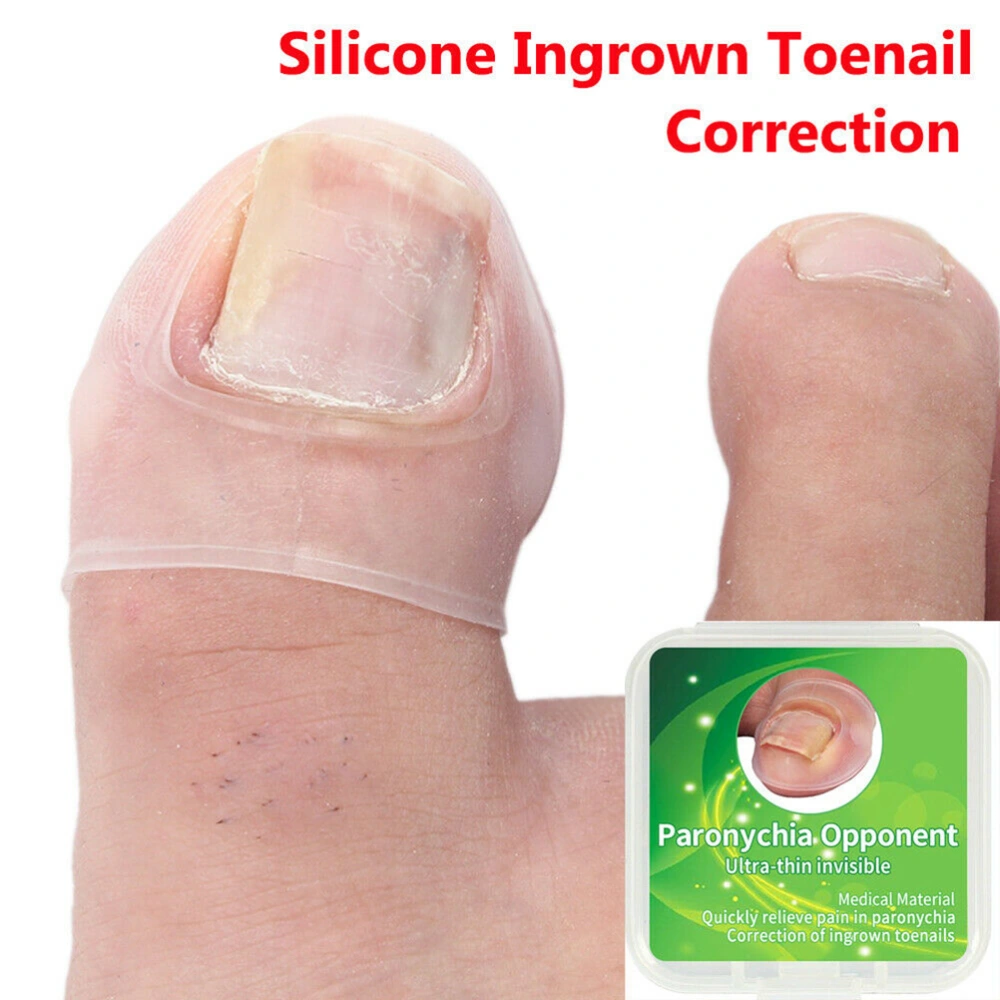 2Pcs Silicone Ingrown Toenail Correction Tool Toe Toenail Protector Big Toe Sleeves Thick Paronychia Correction Tool