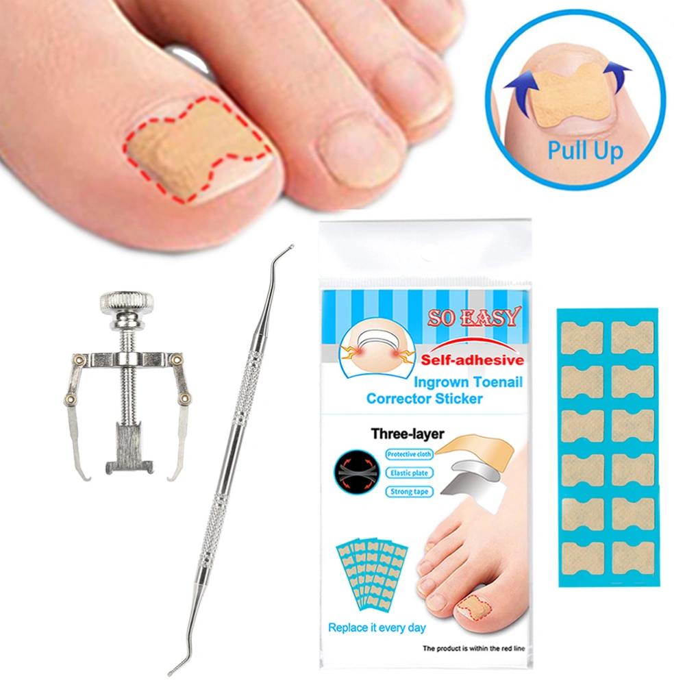 Ingrown Toenail Tools Set Ingrown Toenail Corrector Ingrown Toenail Stickers Set