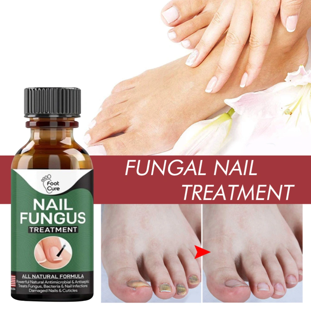 50ML Nail Treatment Solution Nail Repair Liquid Accelerate Metabolism Onychomycosis Treatment Solution