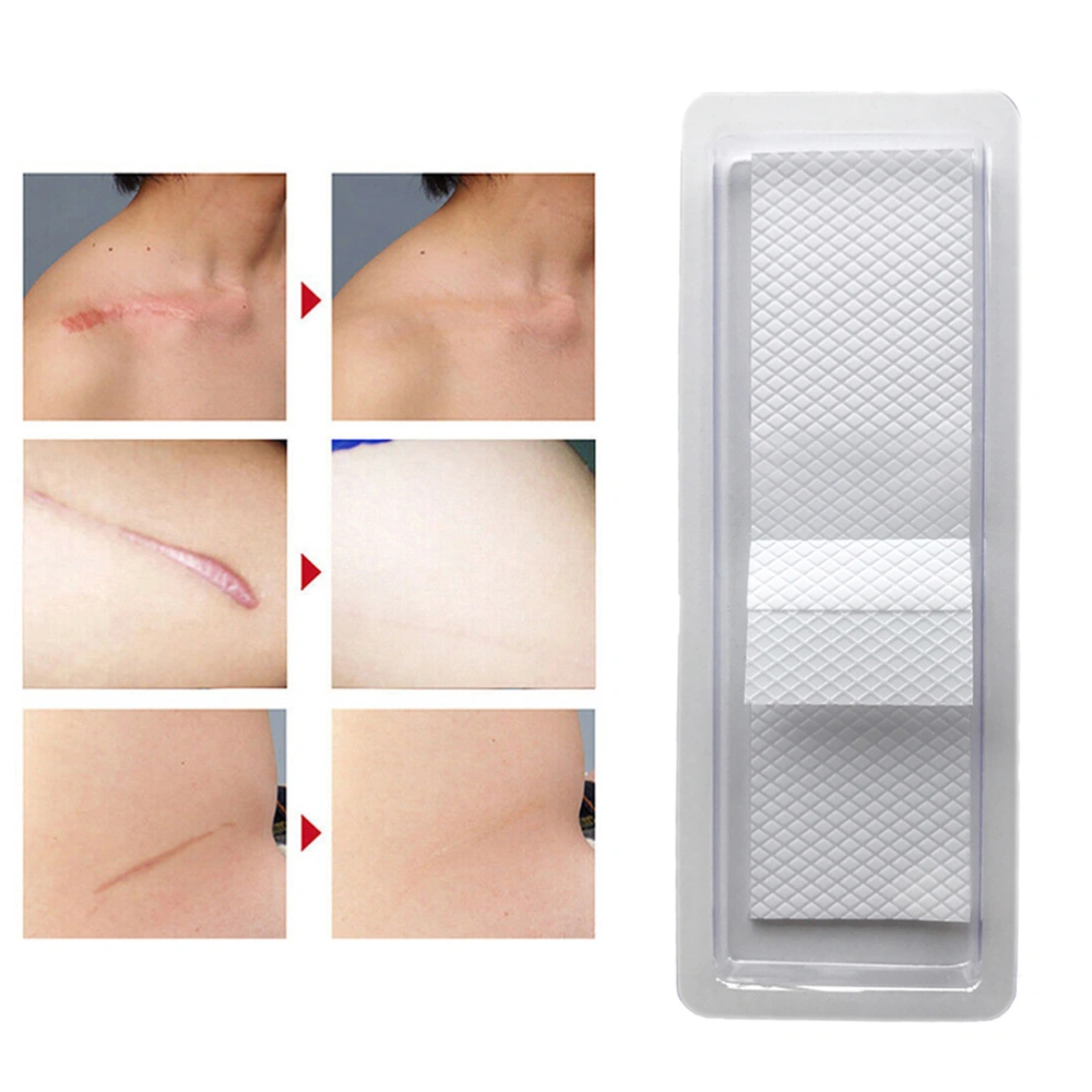 Silicone Removal Scar Patch Reusable Acne Gel Scar Remove Patch Trauma Burn Sheet Skin Care Scar Sticker