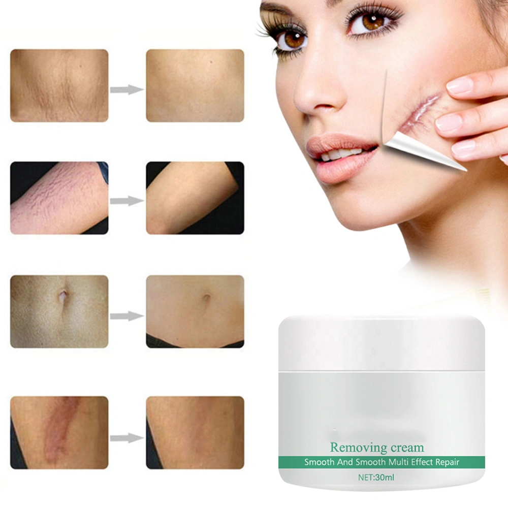 30ml Scar Removal Cream for Old and New Scars from Cuts Stretch Marks Caesarean Sections