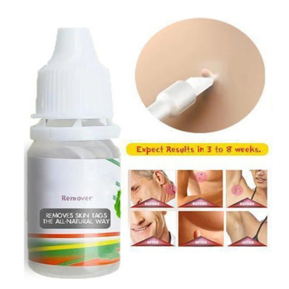 10ml Body Warts Mole Removal Liquid Skin Tag Remover Foot Warts Remover