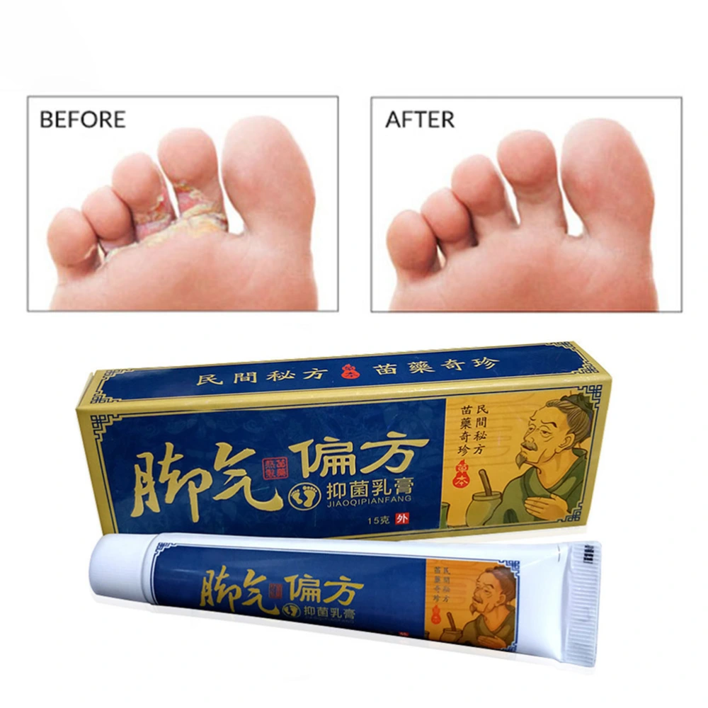 Fungus Removal Foot Cream Nail Fungus Removal Cream Anti Itching Foot Cream Feet Care