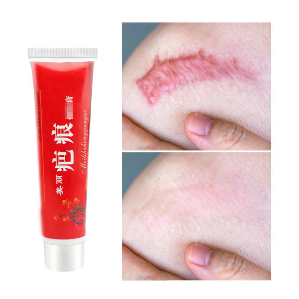 60g Acne Scar Removal Cream Scar Cream Fade Scars and Quick Antipruritic Scar Remover