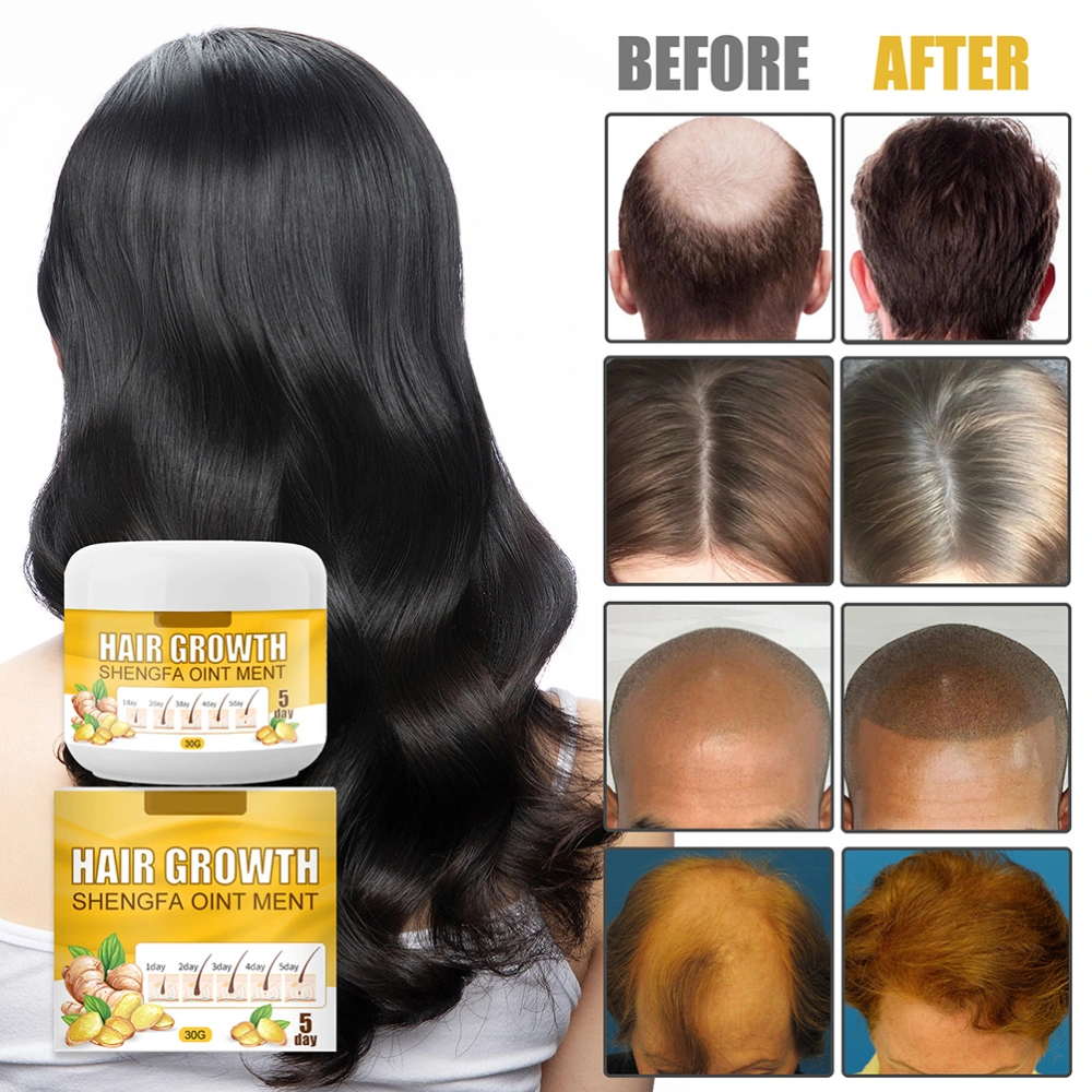 Hair Growth Cream 30g Ginger Hair Loss Ointment Moisturizing Massaging Scalp Hair Care Serum Conditioner