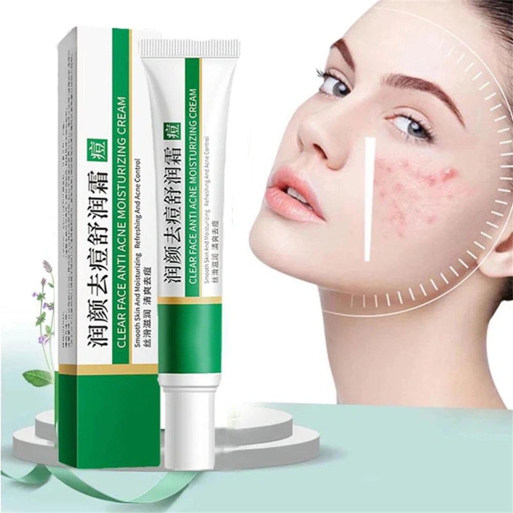 Acne Cream Hydrating and Moisturizing Anti Acne Facial Skin Care Cream Acne Gel Cream for All Skin Types