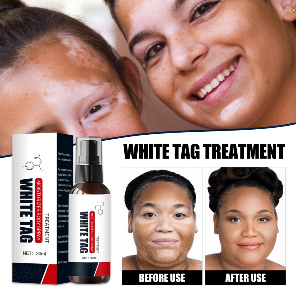 White Spot Cleansing Spray Effectively Remove Skin Pigment Spot Liquid Skin Care Spray