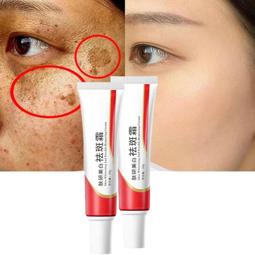 20g Whitening Freckle Removal Cream Lighten Freckle Face Cream Skin Care Cream