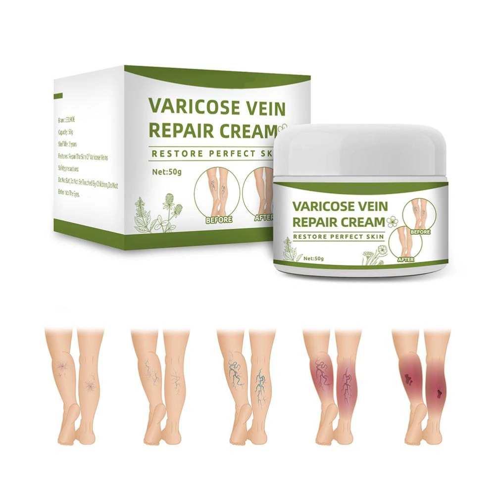 Varicose Veins Cream Natural Ointment for Varicose and Spider Veins Removal Spider Veins